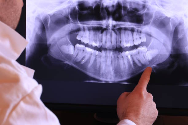 Best Urgent Dental Care in Wacousta, MI
