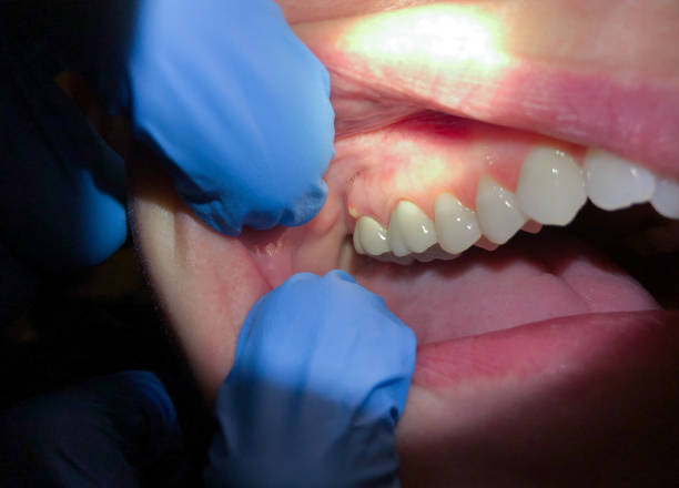 Best Same-Day Emergency Dentist in Wacousta, MI
